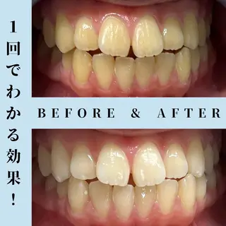 セルフホワイトニング Dolce水戸店のその他イメージ