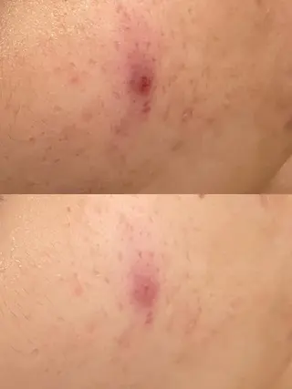 メナードフェイシャルサロン　片町所属・メナードフェイシャル サロン片町店ハタケのエステ・リラクイメージ