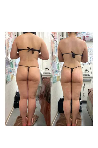 espresso,所属・《痩身、小顔専門店》 エスプレッソのエステ・リラクイメージ