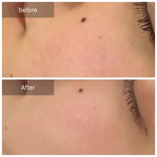 トータルしみケア専門 NICA(ニカ)のエステ・リラクイメージ