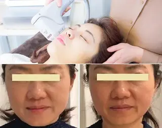 顔脱毛＆毛穴＆ニキビ 優良№1♪ヒロコ♪のエステ・リラクイメージ