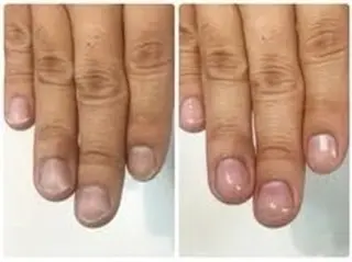 メンズ ネイル 佐々木 彩のエステ・リラクイメージ