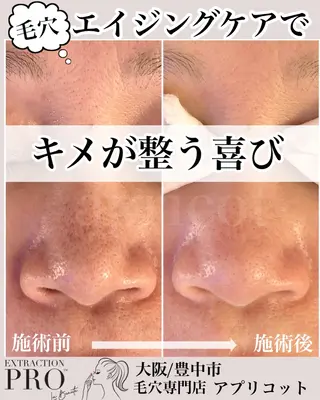 ヘッドスパ専門/豊中 apricotのエステ・リラクイメージ