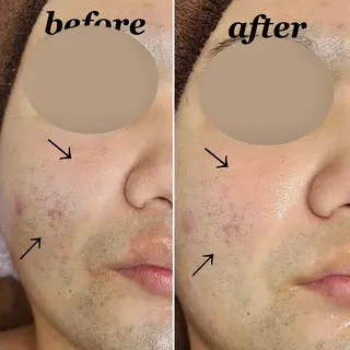 メンズ total beauty DIAのネイルデザイン