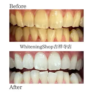 ホワイトニング ショップ吉祥寺店のエステ・リラクイメージ