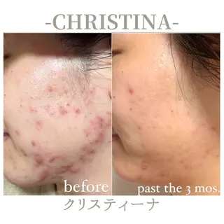 For...天王寺店 リンパ|ヘッドよもぎのエステ・リラクイメージ