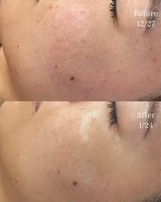 BELLIS HUIT所属・ハーブピーリング那覇 BELLISHUITのエステ・リラクイメージ