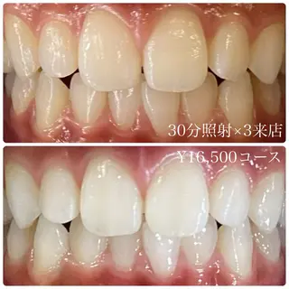 PLATINUM Beauty 横浜店所属・ホワイトニングルーム 横浜店のその他イメージ