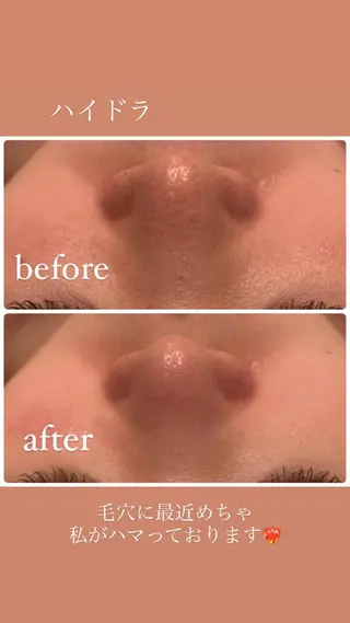 種市 貴子のその他イメージ