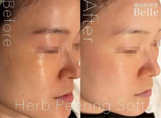 韓国肌管理Belle堀江所属・韓国肌管理 Belle堀江のエステ・リラクイメージ