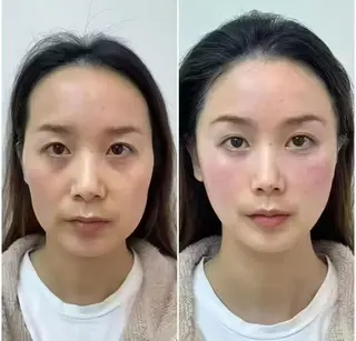 マツエク・マツパ aliaハイフ&水光ジェットサロン所属・aliaハーブ水光店 エステティシャン募集のエステ・リラクイメージ