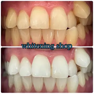 ホワイトニング ショップ吉祥寺店のエステ・リラクイメージ