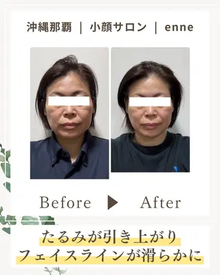 小顔サロンenne所属・小顔サロンenne 【エンネ】のその他イメージ