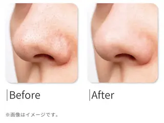 leolo武蔵浦和 肌質改善＆脱毛のエステ・リラクイメージ