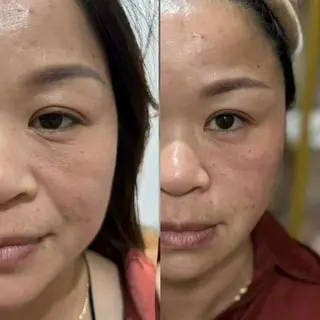 ネイル aliaハイフ&水光ジェットサロン所属・aliaハーブ水光店 エステティシャン募集のエステ・リラクイメージ