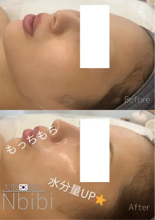 韓国🇰🇷価格 サロン_Nbibiのエステ・リラクイメージ