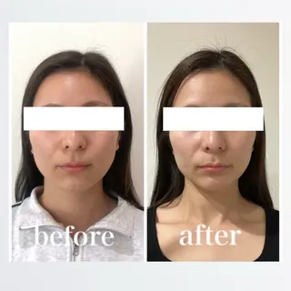 小顔と ヘッドスパのお店のエステ・リラクイメージ