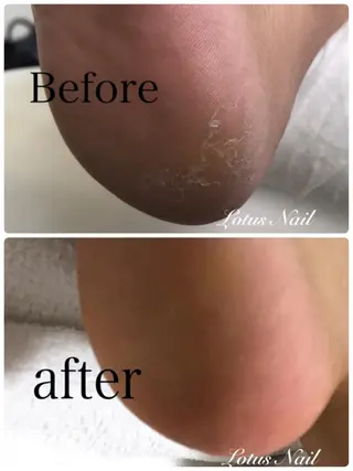 ネイル Lotus Nailのネイルデザイン