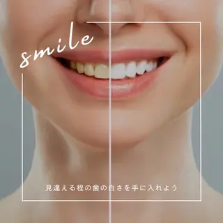 メンズ ホワイトニング ショップ川越店のエステ・リラクイメージ