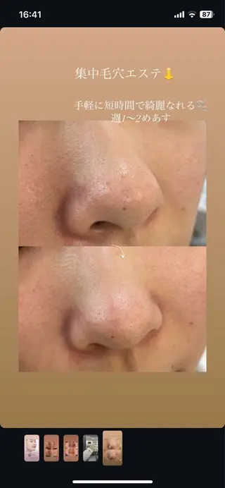 南部 杏奈のエステ・リラクイメージ