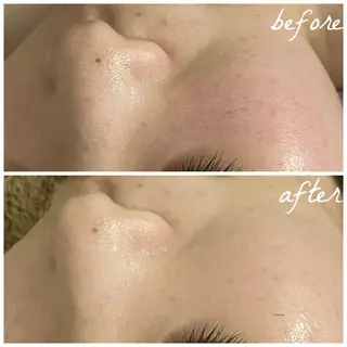 メンズ メナード岐阜茜部 杉浦のエステ・リラクイメージ