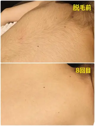 キッズ 【リベルハーブピーリング認定店】敏感肌・美白脱毛専門店Dione立川店所属・Dione 立川店のエステ・リラクイメージ