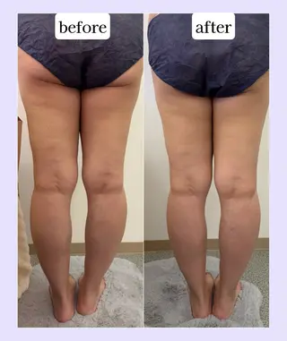 Karen Private Spa所属・💜Karen PrivateSpaのエステ・リラクイメージ