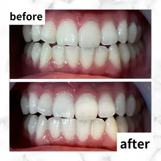 LBSホワイトニング 🌐渋谷店 河内のエステ・リラクイメージ