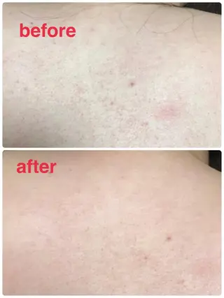 首・肩こり専門リンパ ケアサロンSENKAのエステ・リラクイメージ