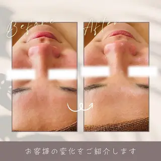 LukeBeauty salonのエステ・リラクイメージ