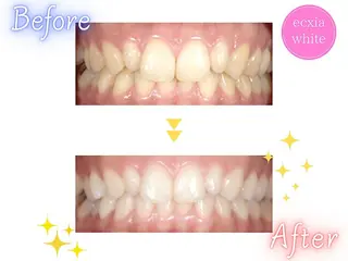 セルフホワイトニング エクシア東上野店のその他イメージ