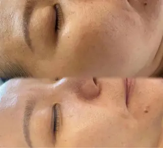 マツエク・マツパ aliaハイフ&水光ジェットサロン所属・aliaハーブ水光店 エステティシャン募集のエステ・リラクイメージ