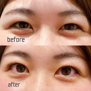 マツエク・マツパ 長岡 真子のマツエク・マツパデザイン