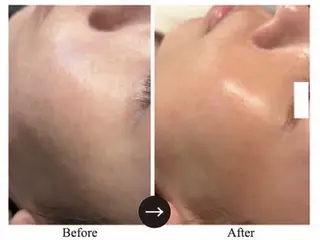 NAZ  (ナーズ)のエステ・リラクイメージ