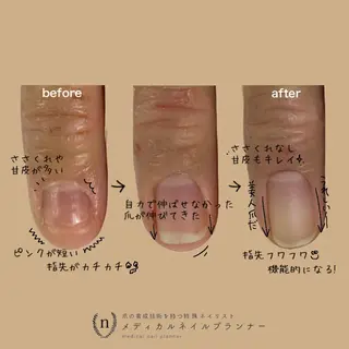 ネイル tsuki elfのエステ・リラクイメージ