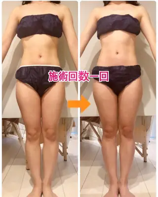 ショート カラー パーマ ヘアアレンジ メンズ キッズ ネイル マツエク・マツパ ‍痩身＆ボディ 結果出し🌟丹野のエステ・リラクイメージ