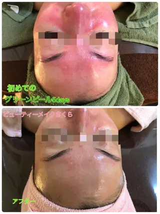 鈴木 さくらのエステ・リラクイメージ