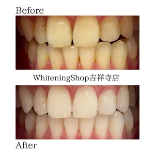 ホワイトニング ショップ吉祥寺店のエステ・リラクイメージ