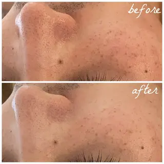 メンズ メナード岐阜市茜部 杉浦のエステ・リラクイメージ