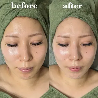 【肌質改善サロン】 リーフィアのエステ・リラクイメージ