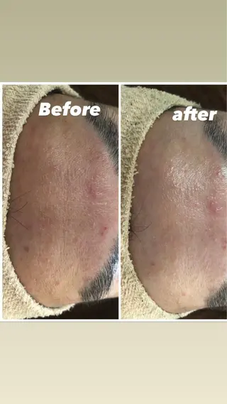 セミロング カラー パーマ ヘアアレンジ メンズ キッズ ネイル マツエク・マツパ Amaryllis 🌹のエステ・リラクイメージ