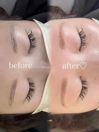 アイブロウ B onitoのエステ・リラクイメージ