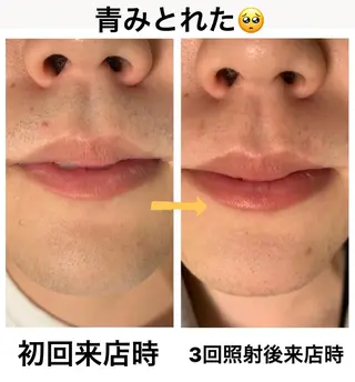 メンズ脱毛サロン Le falcoのエステ・リラクイメージ