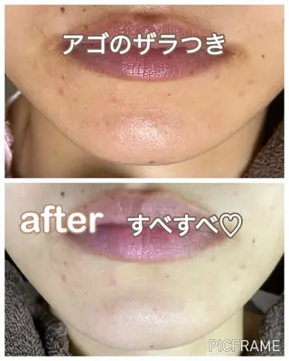 エステルーム　ラティア所属・今井 登美子のエステ・リラクイメージ