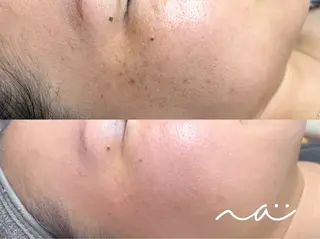 Na ( エヌエー )所属・Na natsumiのエステ・リラクイメージ