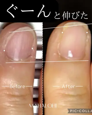 ネイル 深爪・自爪育成専門 MAHALOHIのネイルデザイン