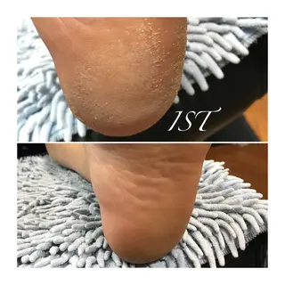 ネイル メンズ歓迎🙆‍♀️ エステ/ネイルISTのエステ・リラクイメージ