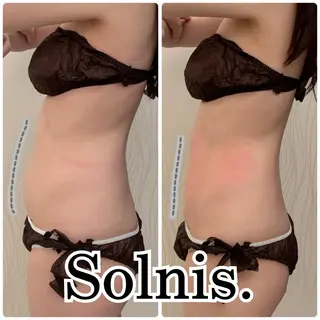 大阪市初！男性もok 酵素浴/痩身/小顔のその他イメージ