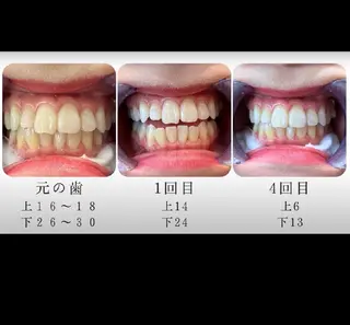 エクシアホワイト旭橋店所属・セルフホワイトニング エクシア旭橋店のその他イメージ