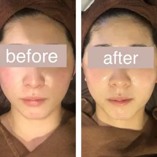 毛穴ニキビ専門 ビューティーグランツのエステ・リラクイメージ